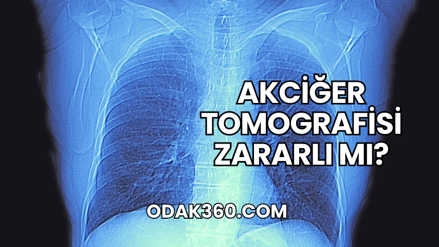 Akciğer Tomografisi Zararlı mı?