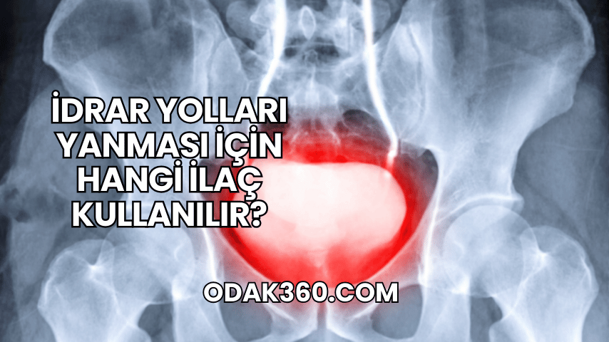 İdrar Yolları Yanması İçin Hangi İlaç Kullanılır?